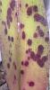 Black spots on Cattleya new leaves only-img_4839-jpg